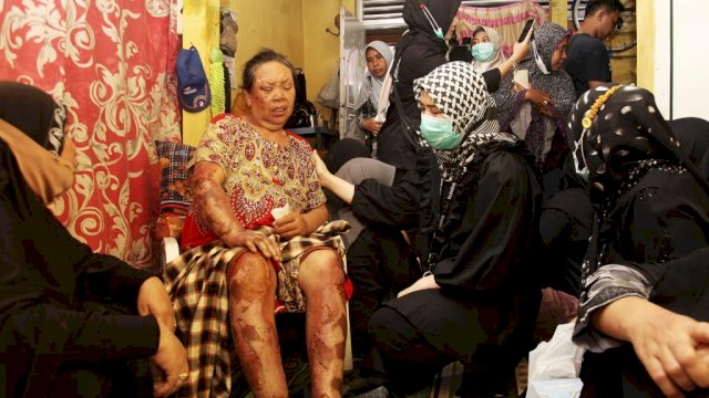 Istri Fadli Ananda Bantu Perawatan Korban Kebakaran Rappokalling